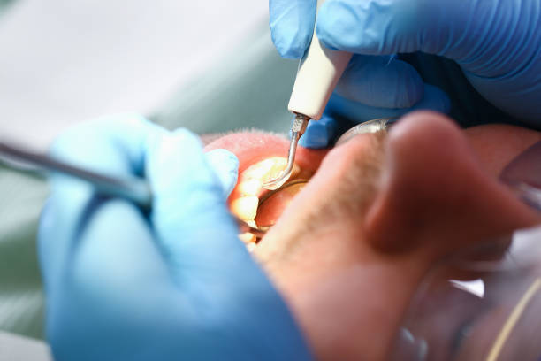 Best Broken Tooth Emergency  in Bristol, CT