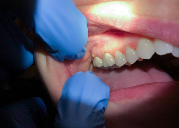 Best Broken Tooth Emergency  in Bristol, CT